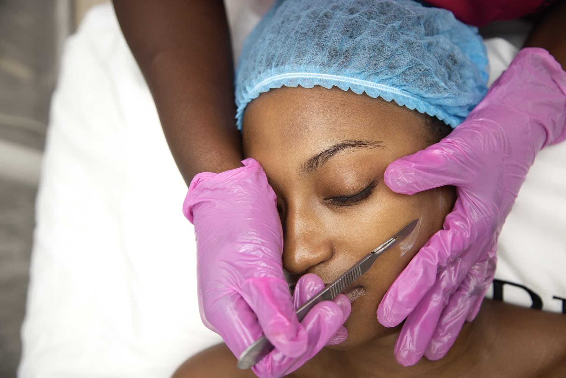 Dermaplaning